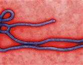 Virus ebola Foto: Wikipedia